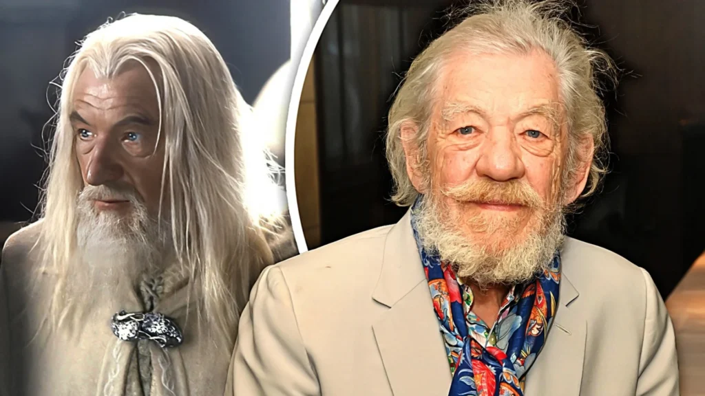 O renomado ator Sir Ian McKellen foi hospitalizado após um acidente durante uma apresentação teatral em Londres.
