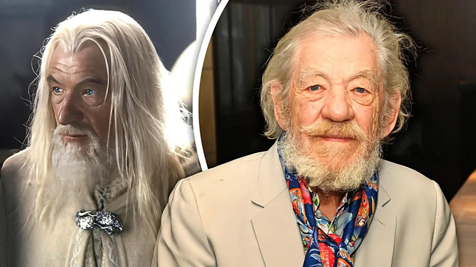O renomado ator Sir Ian McKellen foi hospitalizado após um acidente durante uma apresentação teatral em Londres.