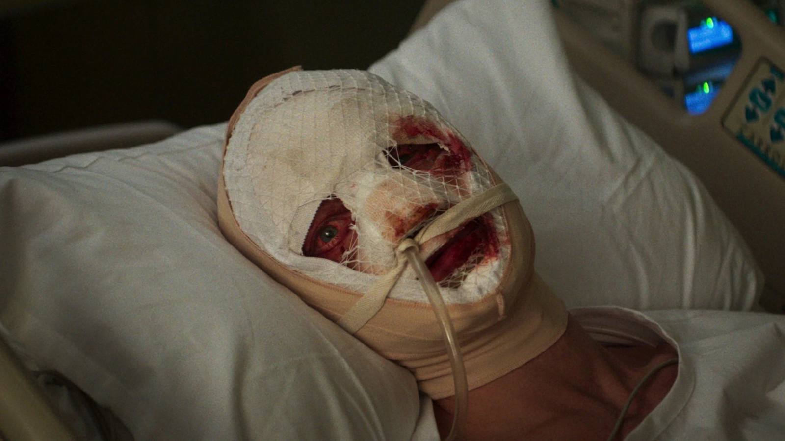 Filme Cara-de-Barro homem em hospital enfaixado